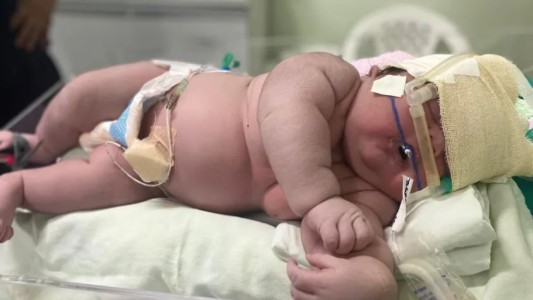"Bebé gigante": nació una niña de más de 7 kilos en Brasil y rompió un récord