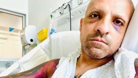 Condenan a exconvencional chileno por simular padecer cáncer para recibir donaciones