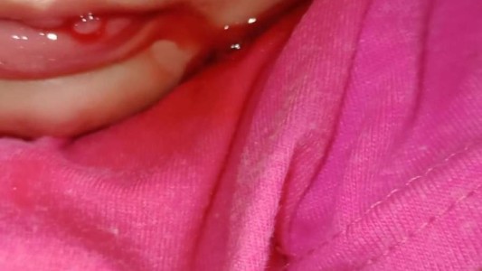 La beba que "sangra por la boca" ya tiene diagnóstico