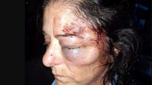 Desfiguraron a una colectivera en un brutal asalto