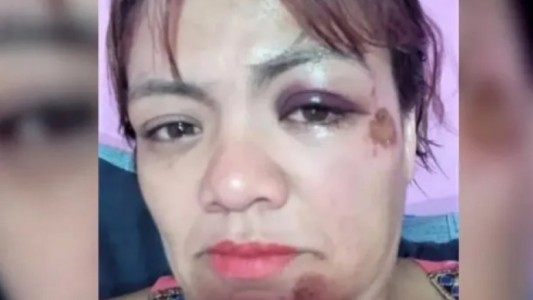 Contó en redes que fue atacada por una jauría y que la Policía no quiso tomarle la denuncia
