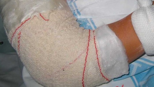 Indemnización: condenan a "frentista" por el accidente que sufrió una mujer por la vereda en mal estado