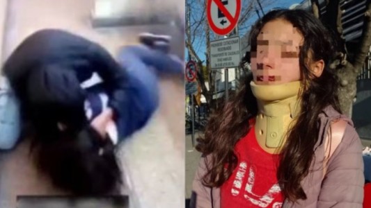 Le dieron una paliza a su hija en la escuela: "Desde el colegio me pidieron la saque"