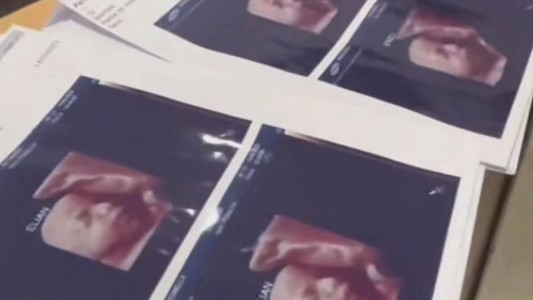 Formosa: escándalo en una clínica que entregó la misma ecografía 5D a sus pacientes embarazadas