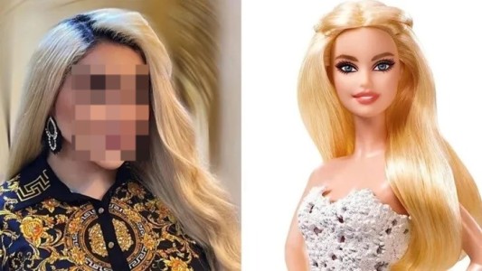 Impactante: se hizo 43 cirugías para parecerse a Barbie