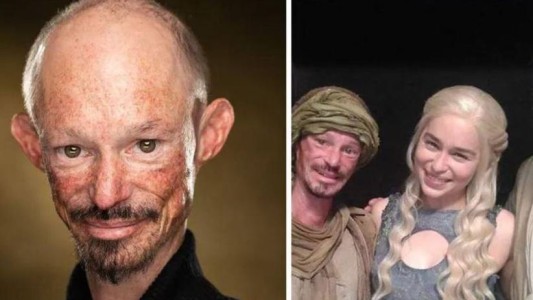 Murió a los 36 años Darren Kent, actor de "Games of Thrones"