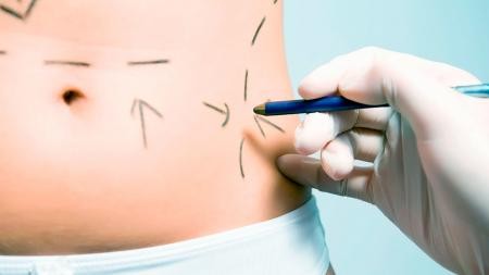 Quince años de prisión para obstetra que hacía tratamientos estéticos y provocó muerte de paciente