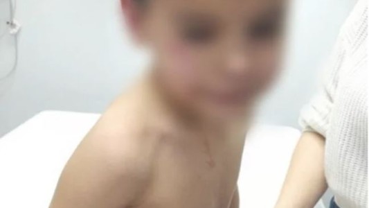 Le disparó a un nene de seis años tras una pelea que había tenido con su papá en un partido de fútbol amateur