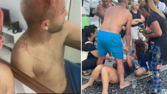 Barras de Fluminense atacaron e hirieron a hinchas de Boca en Copacabana