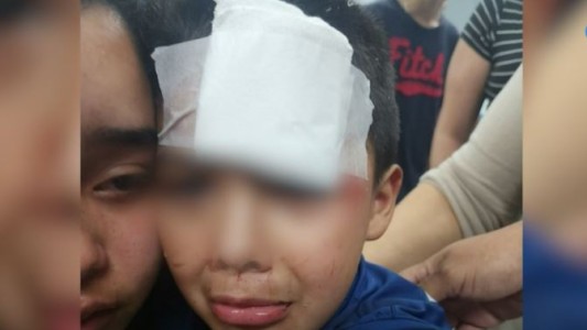 Detuvieron a un policía por atropellar y matar a nene de 9 años y herir a su hermano