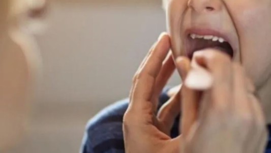 Streptococcus pyogenes: reportaron 487 casos en el país, con 78 fallecimientos