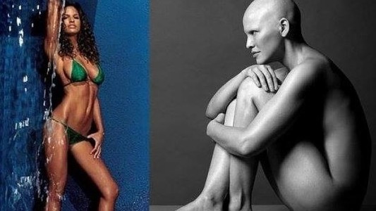 La modelo que mostró los cambios físicos que le provocó el cáncer