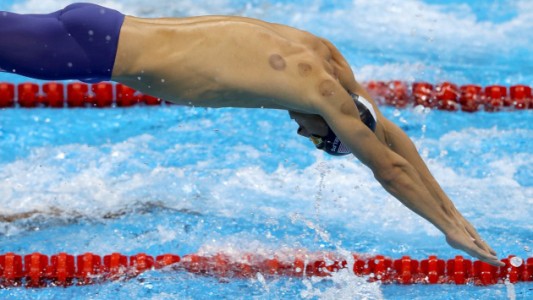 Misterio olímpico: ¿qué son los moretones que tiene Phelps en la espalda?