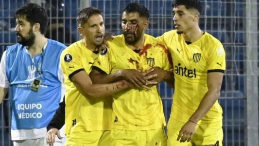 Detuvieron al plateísta de Central que le tiró el piedrazo a Olivera