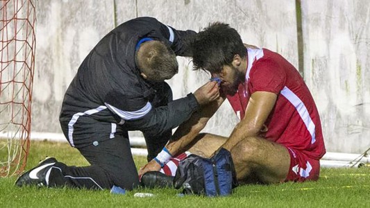 Video: el defensor que cabeceó el palo y se desvaneció