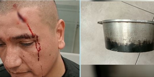 Un policía recibió un "ollazo" en medio de un tiroteo en Ciudad Oculta