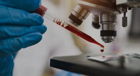 En el mundo un millón de personas contrae una infección de transmisión sexual por día