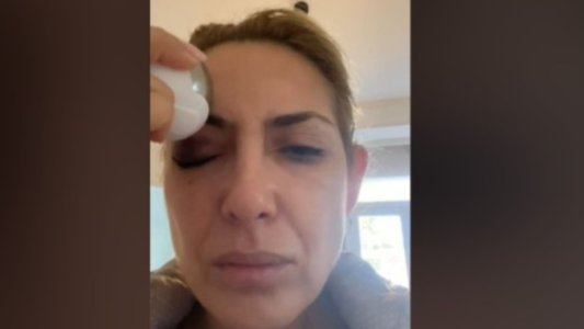 Fabiola Yañez mostró nuevas imágenes en la causa por violencia de género