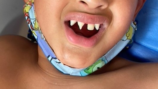 Genodermatosis: el poder del diagnóstico precoz