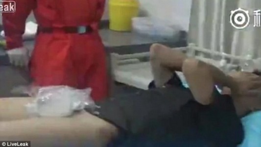 Se puso un anillo en el pene para agrandarlo y terminó asistido por los bomberos en Chile