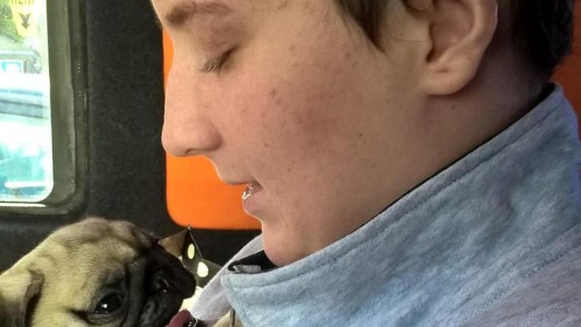 Una joven en coma mueve un dedo en el momento en que iban a desconectarla de la máquina que la mantenía viva