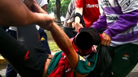 Piden dadores de sangre para el fotógrafo atacado por policías en la marcha de jubilados