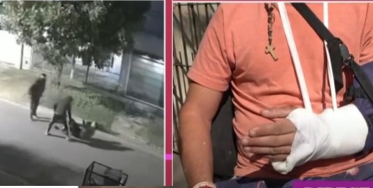 Lo desfiguraron por la moto: "Es la quinta que me roban"