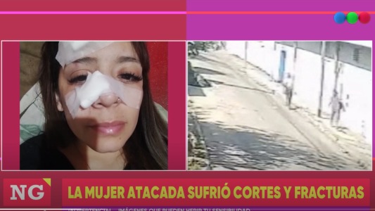 Personas en situación de calle atacaron a una mujer que salía del supermercado