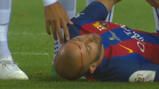 Final de la Copa del Rey: fuerte golpe de Mascherano en la cabeza