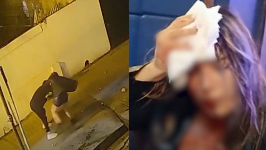 Le pegó un ladrillazo en la cabeza a una chica para robarle: terminó detenido