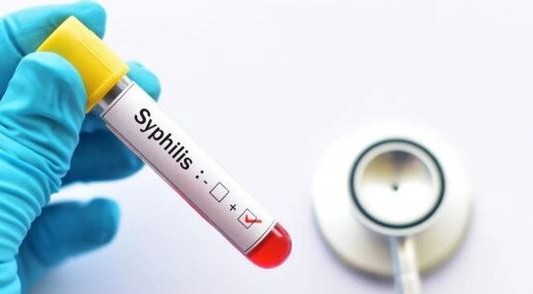 Preocupa el avance de la sífilis: se triplicaron los casos en adolescentes y recién nacidos