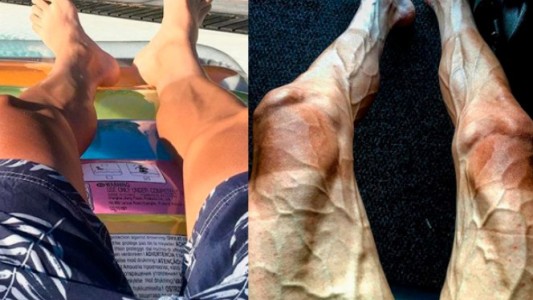 Impresionante: así quedan las piernas de un ciclista del Tour de Francia