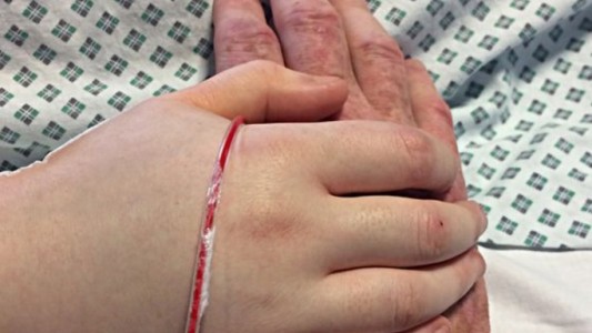 El padre que publicó fotos de la agonía de su hija como una forma de denunciar el bullying que sufrió