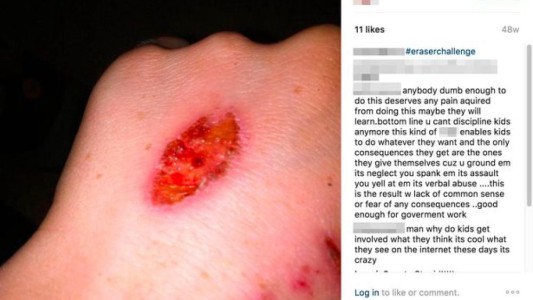 Alarma en Inglaterra por el peligroso "juego de la goma de borrar"