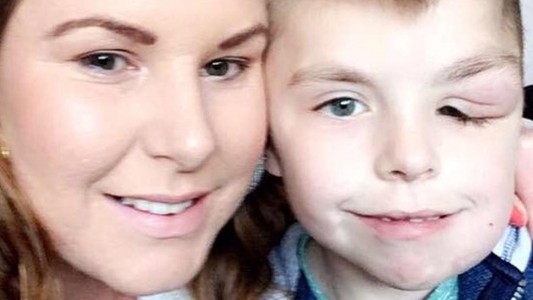 La difícil vida de un nene con la enfermedad del "hombre elefante"