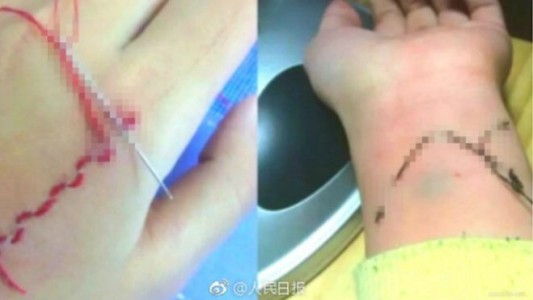 Alerta en China por un juego en el que los jóvenes se bordan la piel