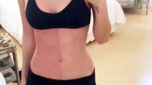 El extraño caso de la mujer que tiene su cuerpo dividido en dos colores de piel