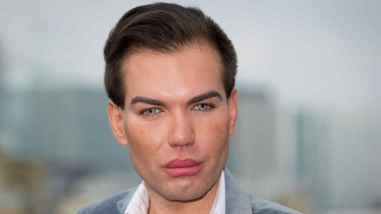 El terrible diagnóstico médico que recibió el "Ken humano"