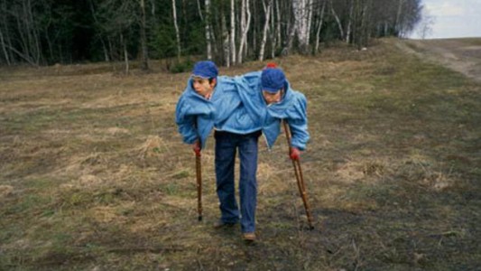 La increíble historia de las siamesas soviéticas que vivieron unidas hasta los 53 años