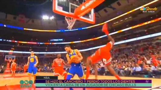 NBA: se hizo el canchero y perdió todos los dientes