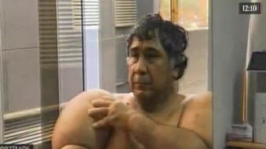 El calvario del hombre que vive con el cuerpo inflado por culpa del nitrógeno que aspiró