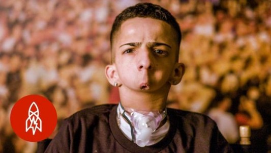 La historia del joven que nació sin mandíbula y triunfa como rapero