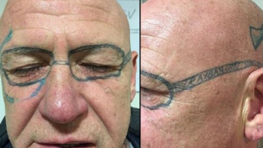 Le tatuaron unos anteojos en la cara en una despedida de solteros y tardó dos años en borrarse el dibujo