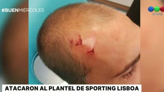 Atacaron al plantel de Sporting Lisboa