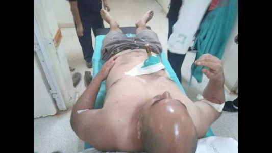 Corrientes: lo apuñalaron y fue a pedir ayuda a la comisaría, con el cuchillo en el ombligo