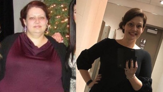 La mujer que adelgazó 70 kilos con sólo tres tips de su nutricionista