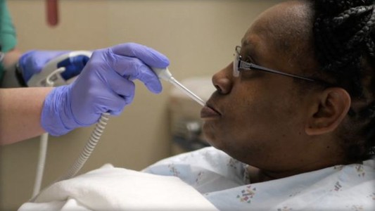 El extraño caso de la mujer perdía líquido del cerebro por la nariz