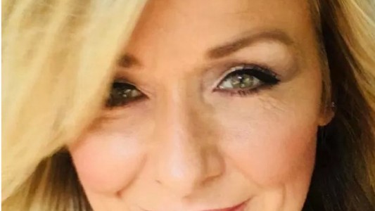 Así le quedaron los ojos a la mujer que no se sacó la máscara de pestañas durante 25 años