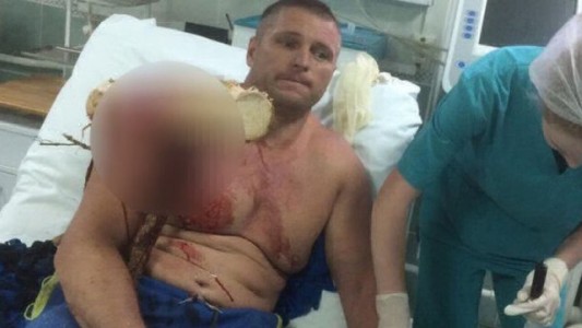 Estremecedor: cayó con su parapente y un tronco le atravesó el cuerpo