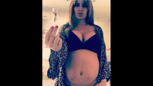 Florencia Peña publicó una foto de los moretones de su panza para visibilizar el drama de la trombofilia